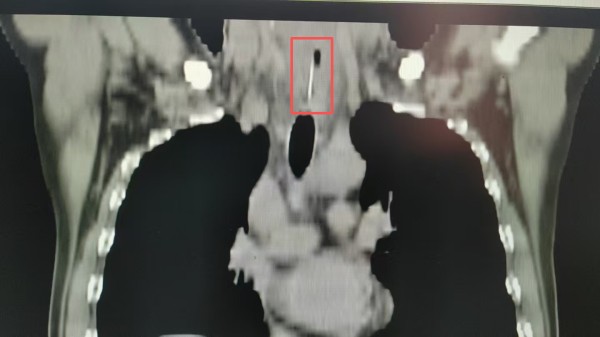 DM_20260813172144_002.jpg